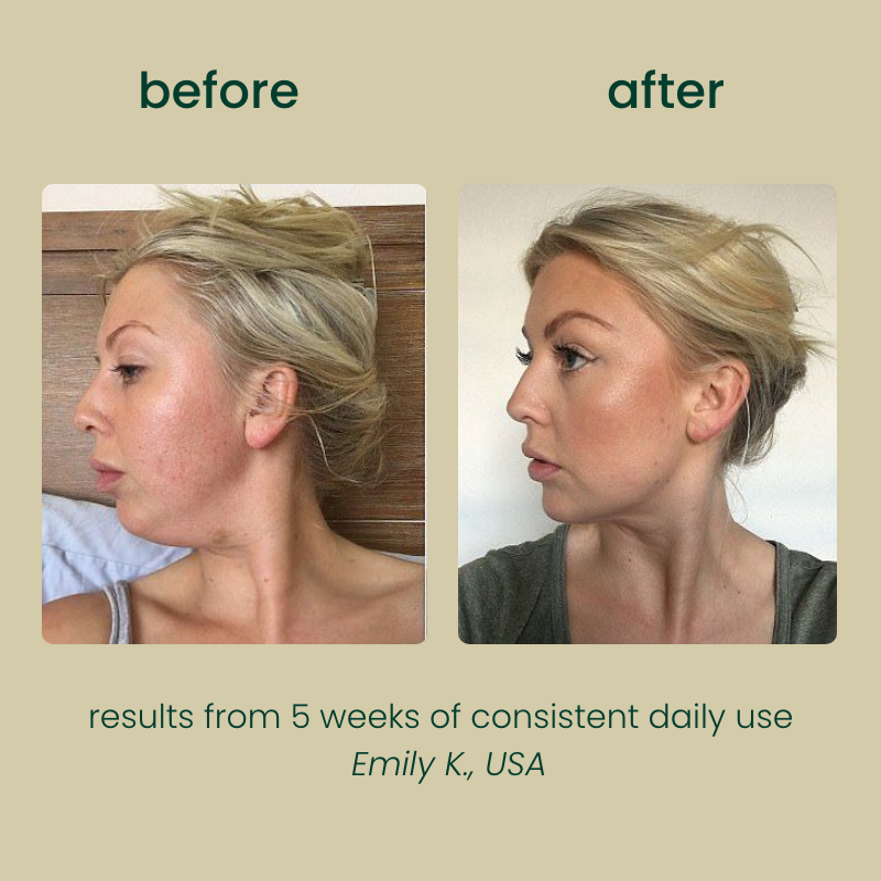 Nutrava Lymphatic Drainage Drops