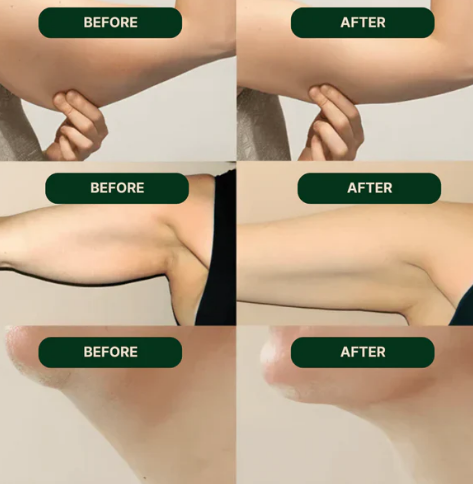 Nutrava Lymphatic Drainage Drops